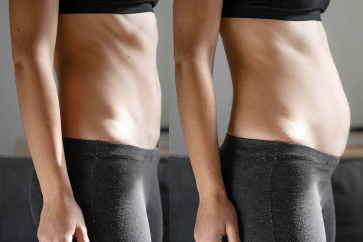 How long does diastasis recti take to improve Leeds?