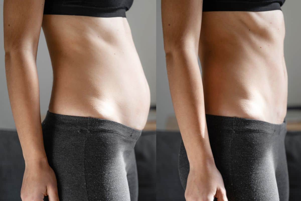 Post-Pregnancy: What Happens to Your Abdominal Muscles After Birth Leeds