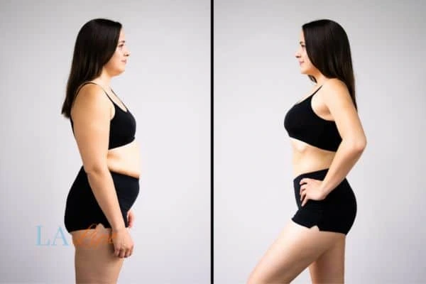 Picture of womans before and after using LA-EMS body sculpting to improve her core strength Leeds