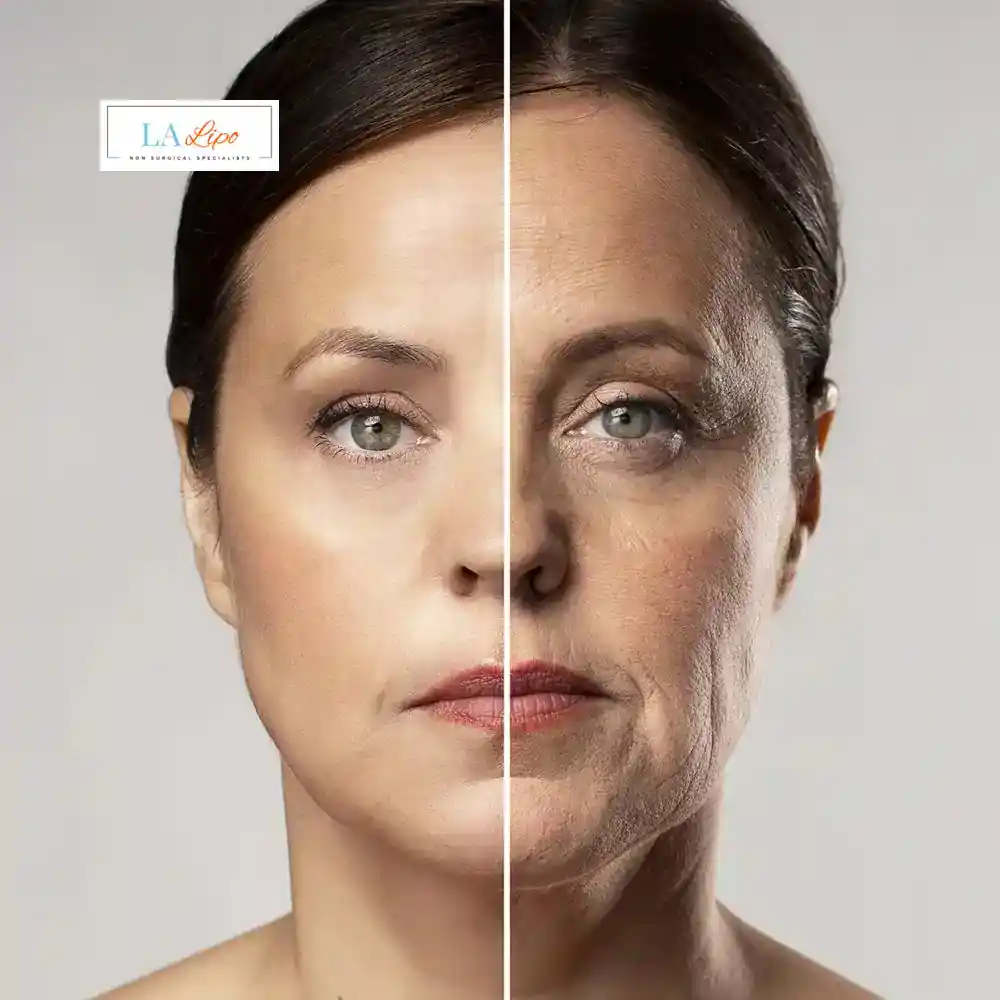 How Can You Tell If Non-Surgical Skin Tightening Is Right for You Leeds?